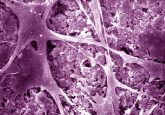 Colorized scanning electron micrograph shows bone cells attaching to a new type of bone cement made of calcium phosphate.