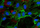 Novel MSC matrix developed for diabetic wound healing