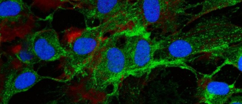 Novel MSC matrix developed for diabetic wound healing