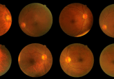 New stem cells discovered in the eye may aid development of glaucoma therapy
