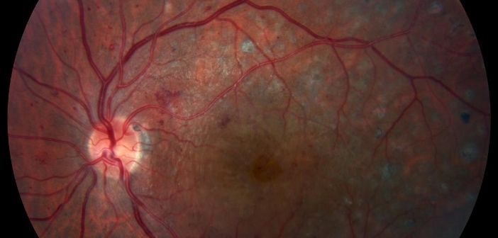 Novel cell injection method could help reverse vision loss