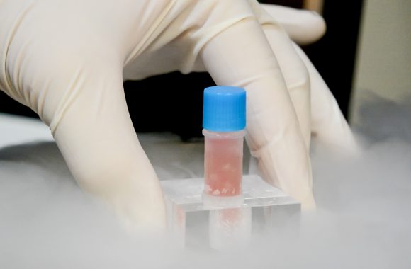 Hand picking up cryostorage vial