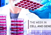 CAR-T cell therapy