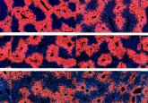 gene therapies