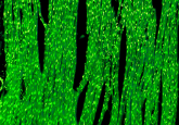 False colour image of heart muscle
