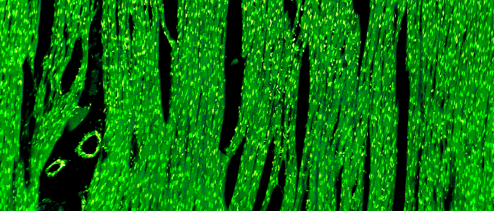False colour image of heart muscle
