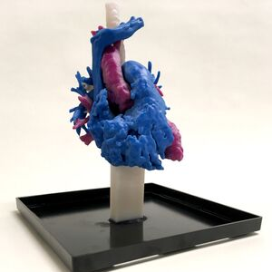 Blood volume trachea Blood volume trachea