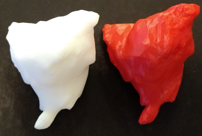 3D printed tumor model 3D printed tumor model