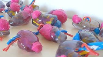 Stratasys full-color multi-material kidney models
