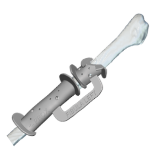 Fibula cutting guide Fibula cutting guide