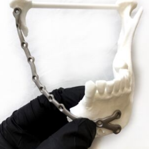 Mandible plate Mandible plate
