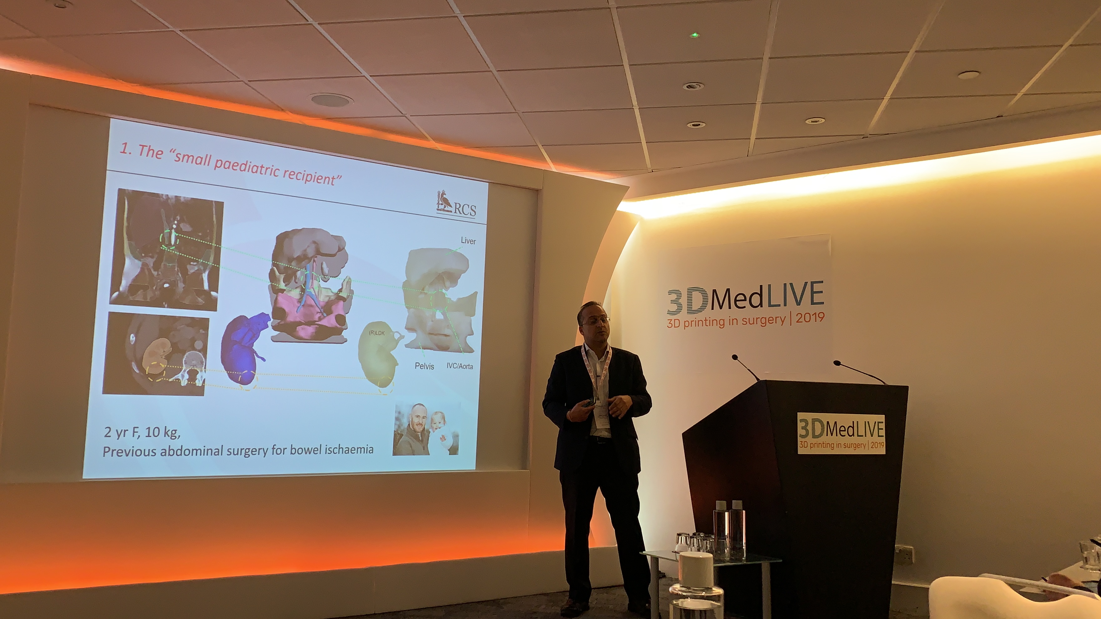 Pankaj Chandak (Guy's, St Thomas and Great Ormond Street Hospitals)