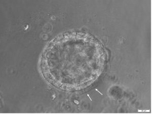 Differentiation of HBEpC after 16 days of 3D culture in ALI-Airway. Bright-field microscopy shows the polarized epithelial cell lining of the organoids and the inner central lumen. Arrows indicate differentiated, outside oriented ciliated cells. Scale bar = 20 µm.