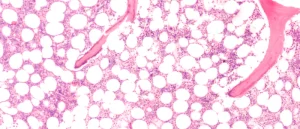 bone organoid
